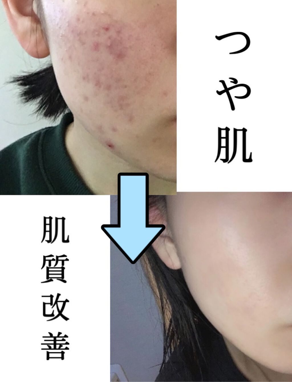 化粧水・敏感肌用・高保湿タイプ/無印良品/化粧水を使ったクチコミ（1枚目）