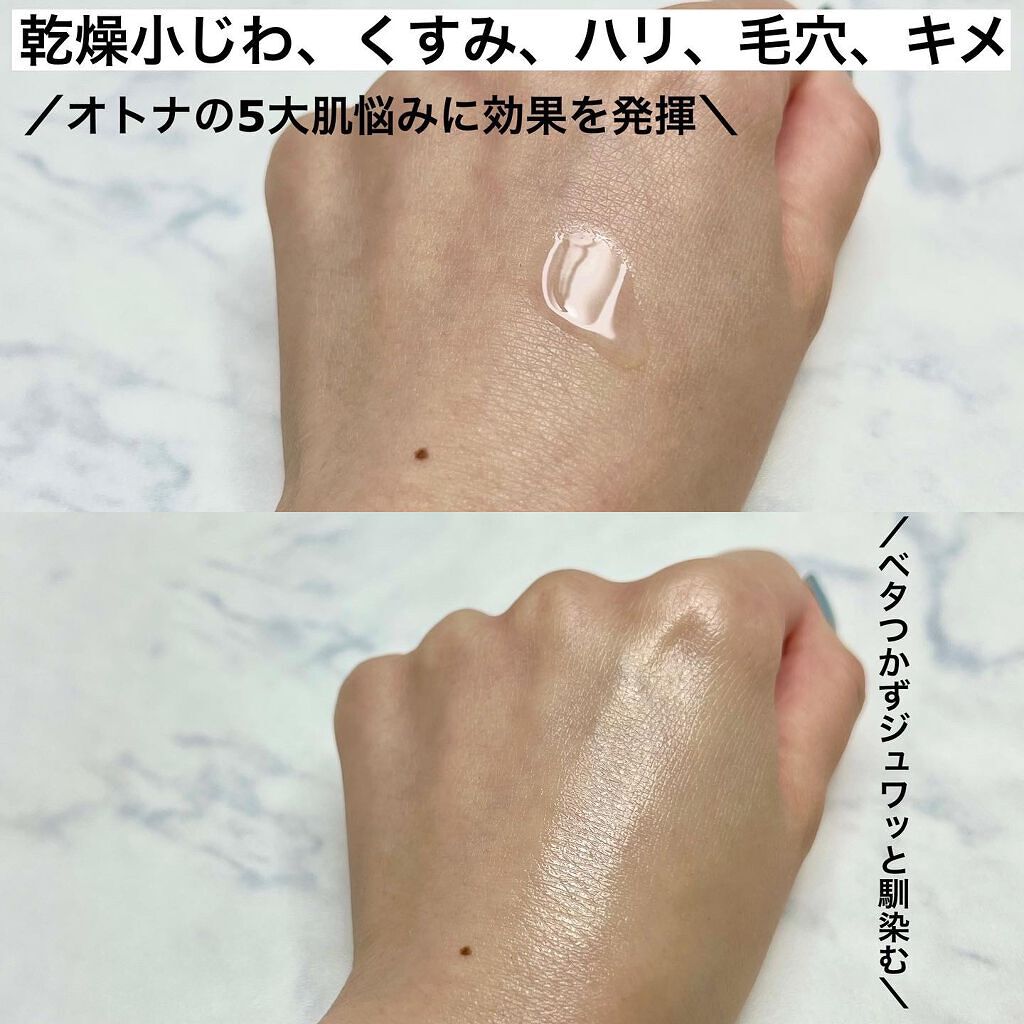 オバジX リフトローション/オバジ/化粧水を使ったクチコミ(5枚目)