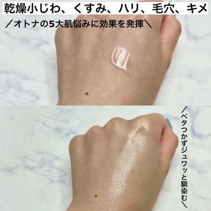 オバジX リフトローション/オバジ/化粧水を使ったクチコミ(5枚目)