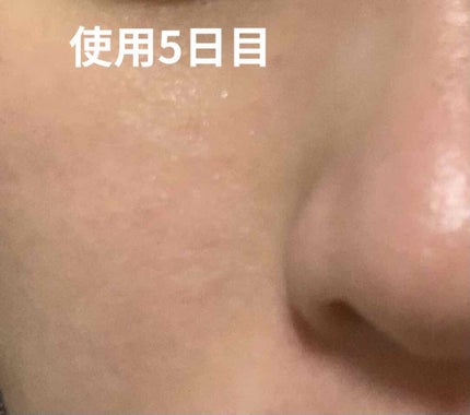 キールズ クリーム SP/Kiehl's/フェイスクリームを使ったクチコミ(6枚目)