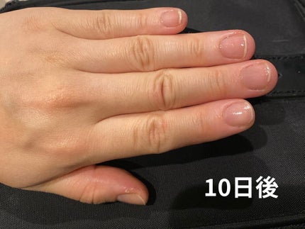 ネイルトリートメント N/ネイルネイル/ネイルオイル・トリートメントを使ったクチコミ(2枚目)