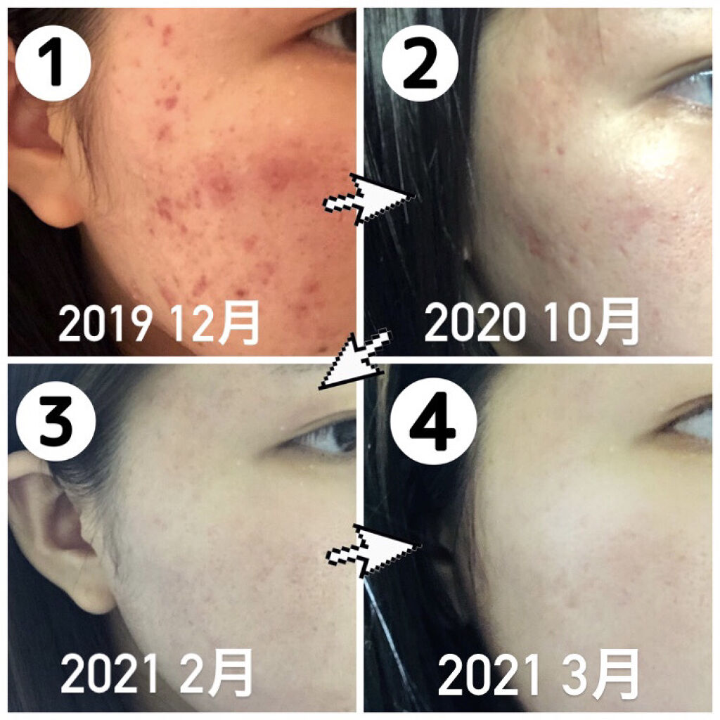 化粧水・敏感肌用・高保湿タイプ/無印良品/化粧水を使ったクチコミ（3枚目）