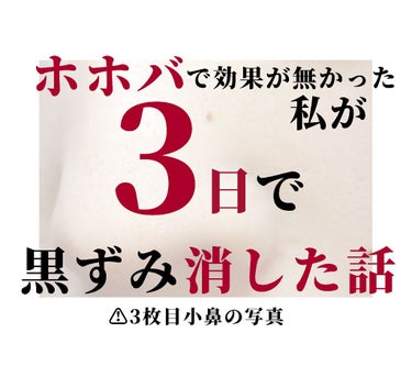 エルベナ 薬用エルベナソープのクチコミ「こんにちは☺️


今回は

ホホバで効果のなかった小鼻の黒ずみを
3日で抹消したやり方をご紹.....」（1枚目）