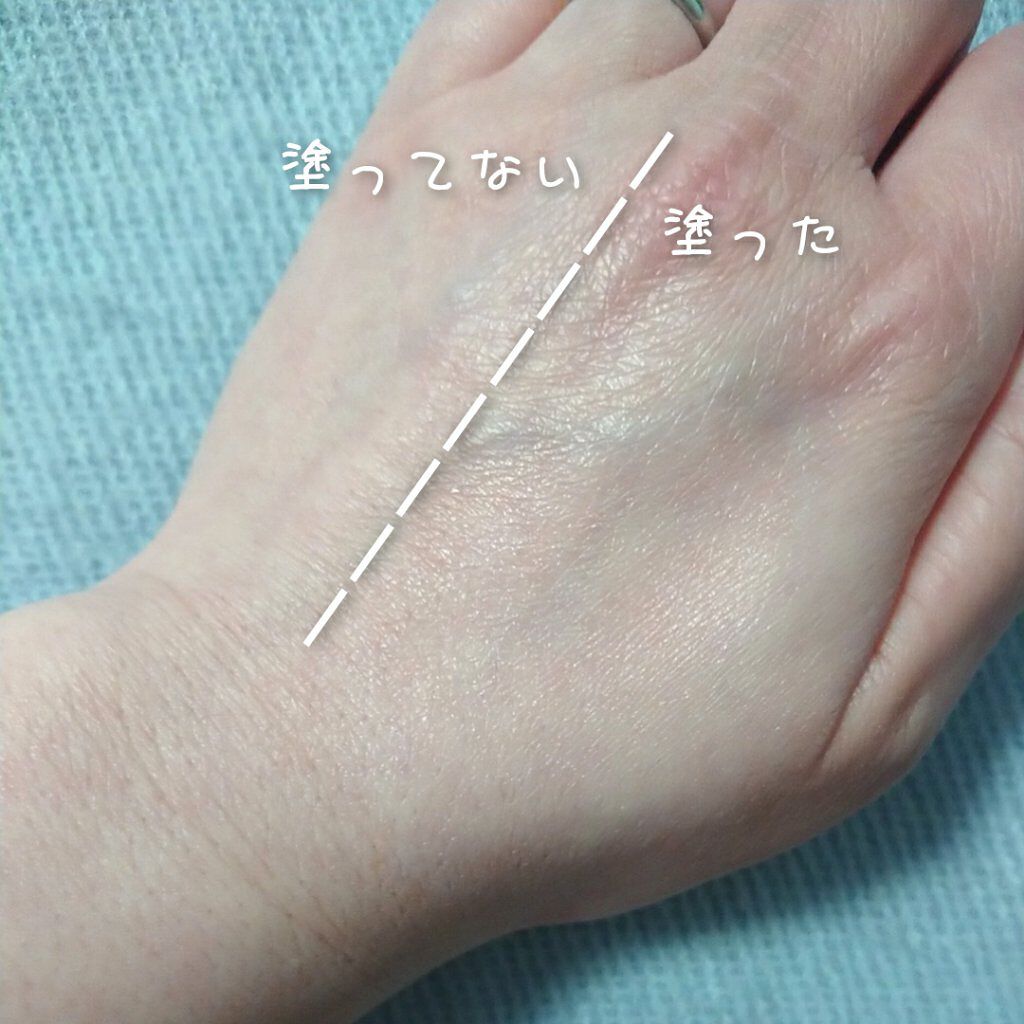 アレルバリア エッセンス N/d プログラム/美容液を使ったクチコミ(2枚目)