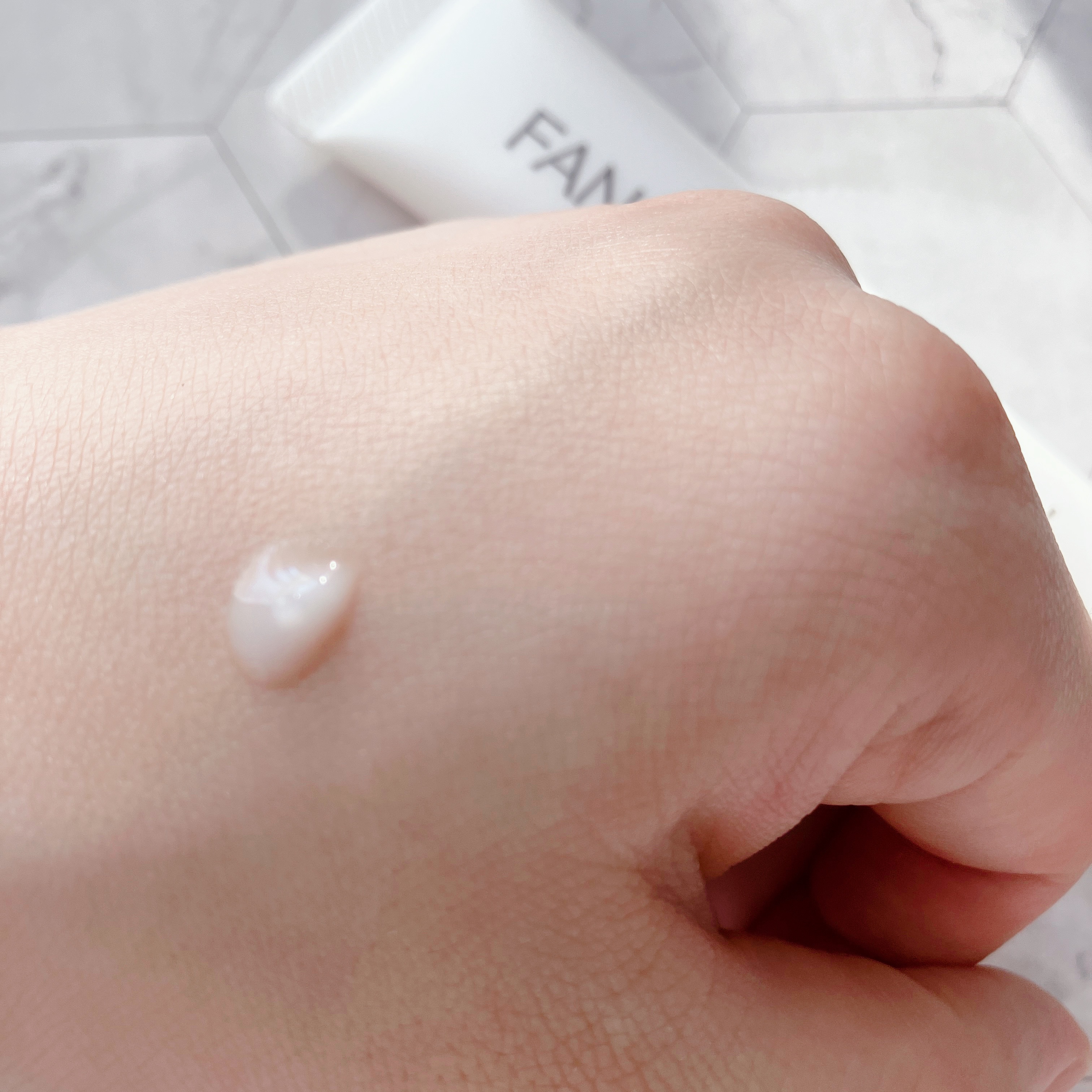 アクネケア 化粧液　＜医薬部外品＞/ファンケル/化粧水を使ったクチコミ（3枚目）