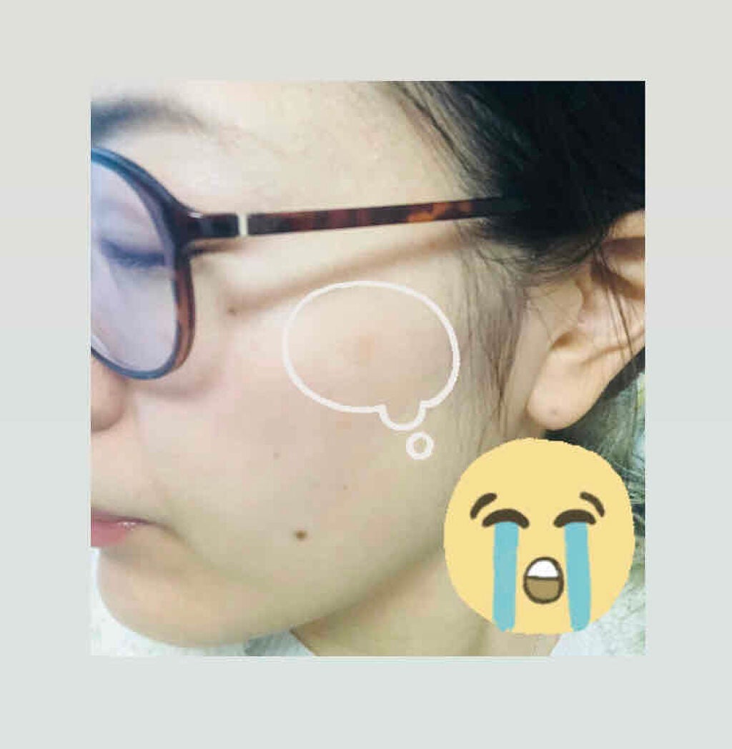 薬用ホワイトニングエッセンスEXII/トランシーノ/美容液を使ったクチコミ(5枚目)