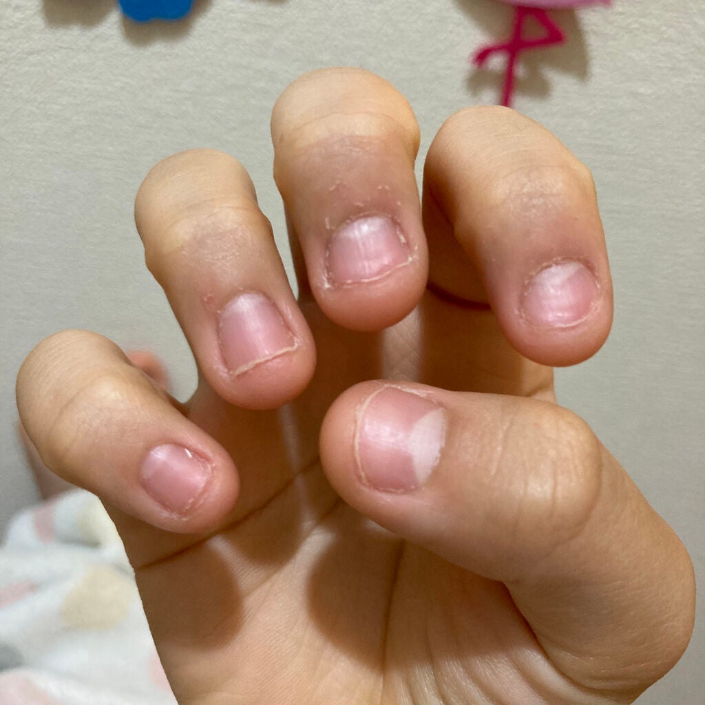 fabulous_make_664i on LIPS 「小さい頃から、今までずっと爪噛みを辞めることができません。共感..」(2枚目)