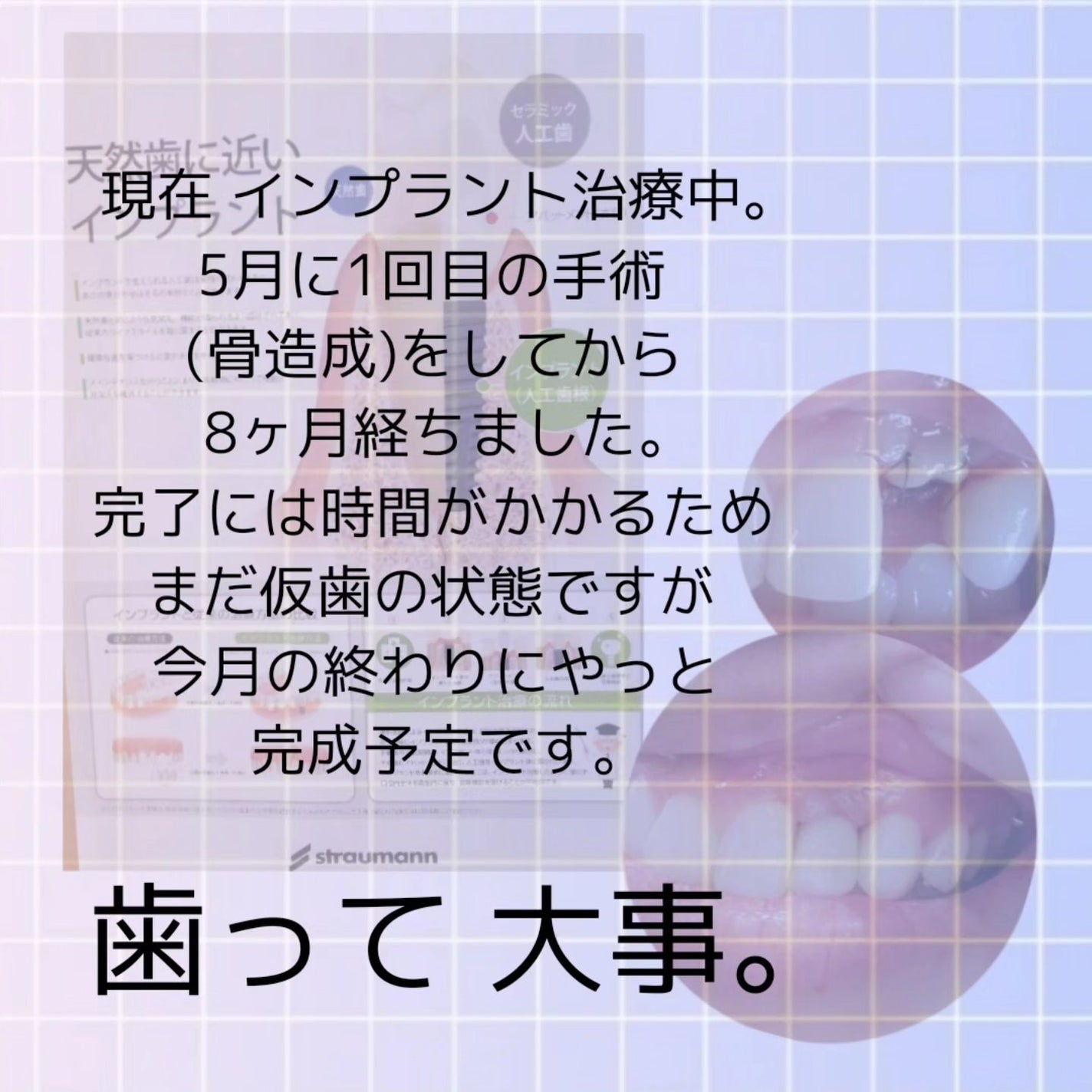 薬用トゥースペースト/B BREATH/歯磨き粉を使ったクチコミ(4枚目)