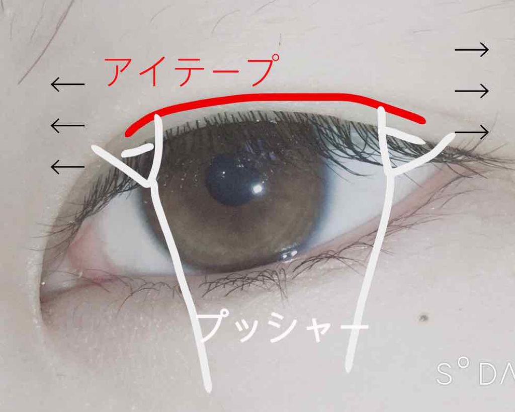 のびーるアイテープ スリムタイプ/DAISO/二重まぶた用アイテムを使ったクチコミ（2枚目）