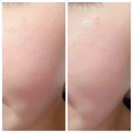 クリアニックホワイトトナー/Dr.Twenty Project/化粧水を使ったクチコミ(4枚目)