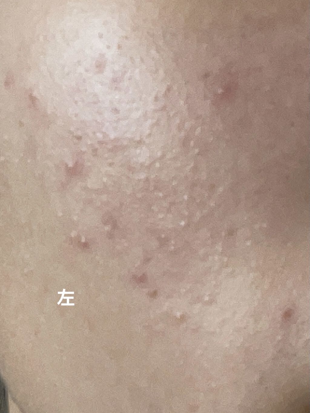 ハトムギ化粧水(ナチュリエ スキンコンディショナー R )/ナチュリエ/化粧水を使ったクチコミ（1枚目）