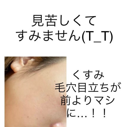 BHA ピーリングアンプル/beplain/美容液を使ったクチコミ(3枚目)