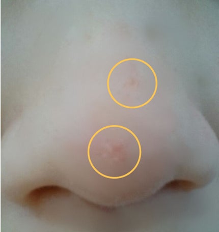白色ワセリン(医薬品)/健栄製薬/その他を使ったクチコミ(2枚目)
