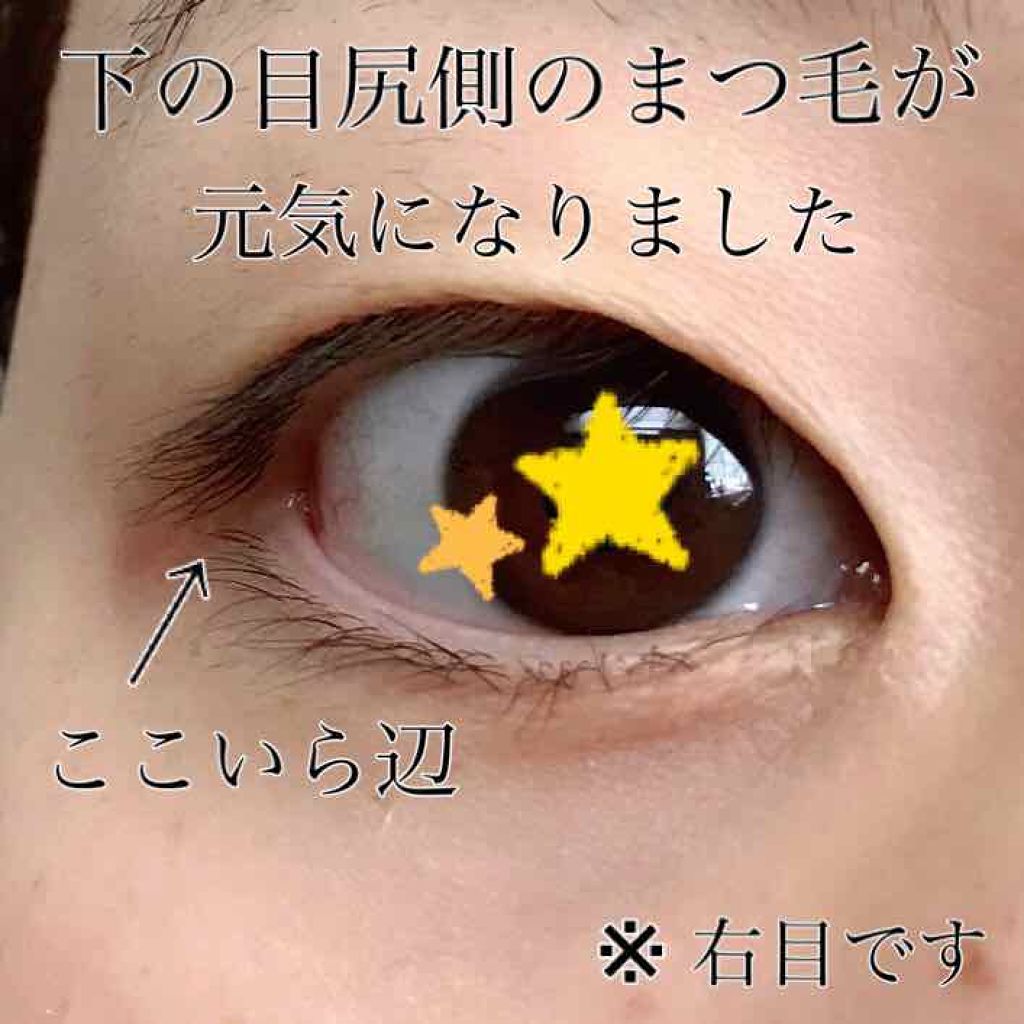 スカルプD ボーテ ピュアフリーアイラッシュセラム/アンファー(スカルプD)/まつげ美容液を使ったクチコミ(3枚目)