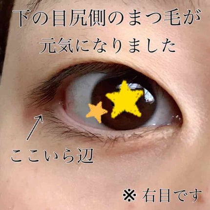 スカルプD ボーテ ピュアフリーアイラッシュセラム/アンファー(スカルプD)/まつげ美容液を使ったクチコミ(3枚目)