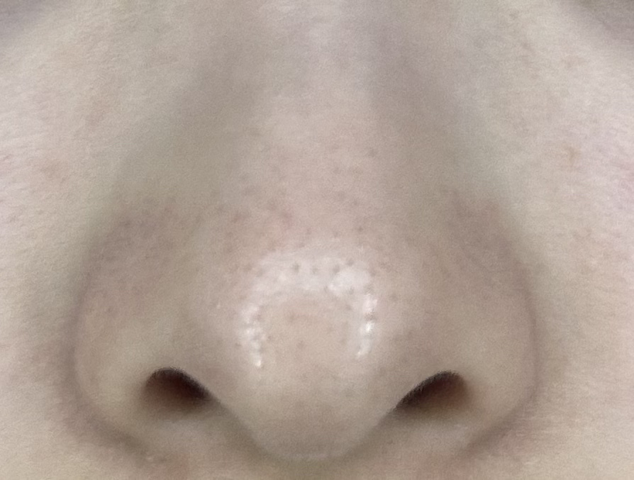 デュオ ザ クレンジングバーム ブラックリペア /DUO/クレンジングバームを使ったクチコミ（2枚目）