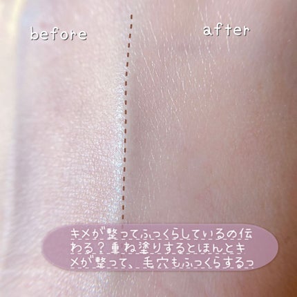 ウォータリィ モイスト クリーム/Moonyu(モーニュ)/フェイスクリームを使ったクチコミ(5枚目)