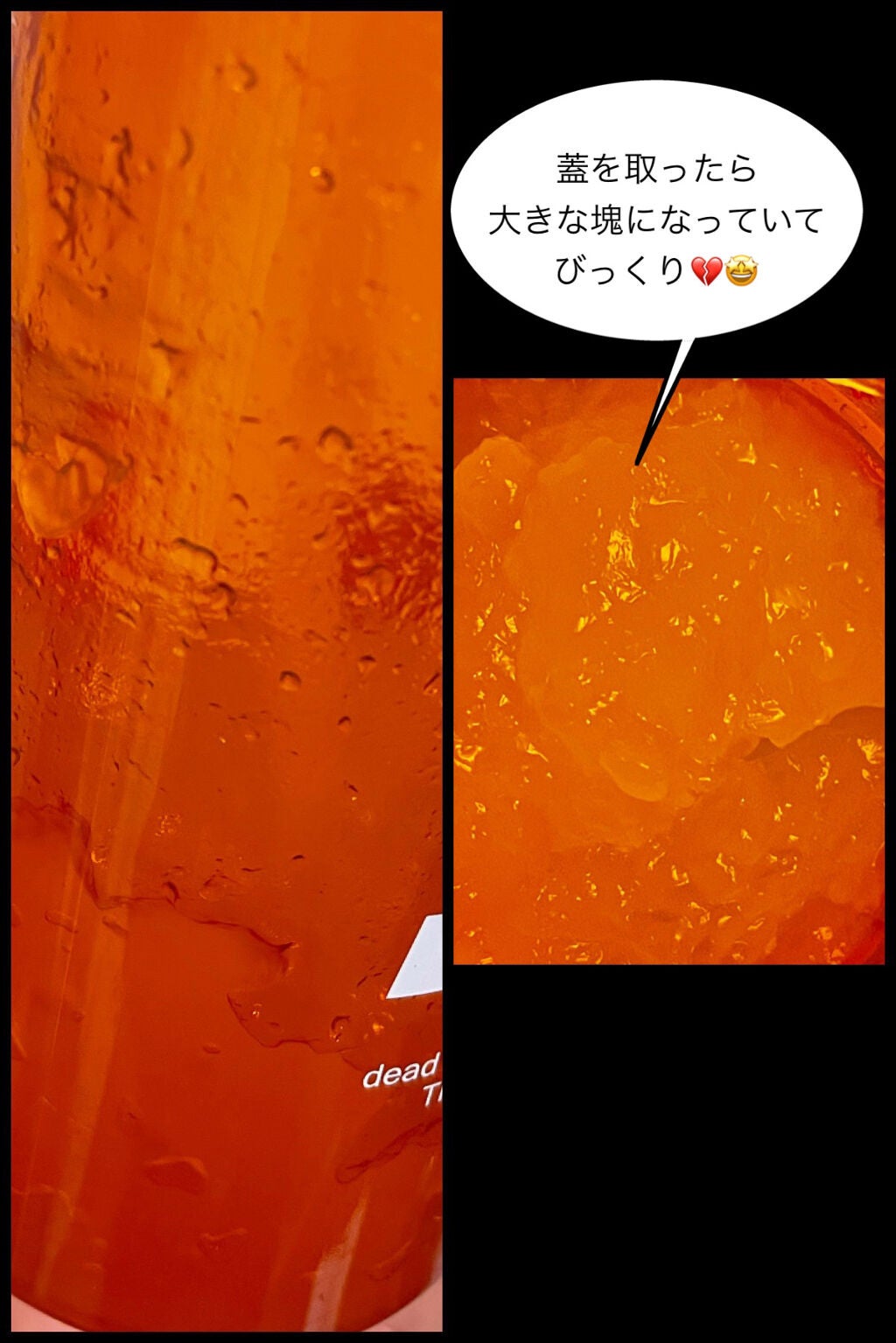 ホワイトピーリングジェル/skinvill/ピーリングを使ったクチコミ(2枚目)