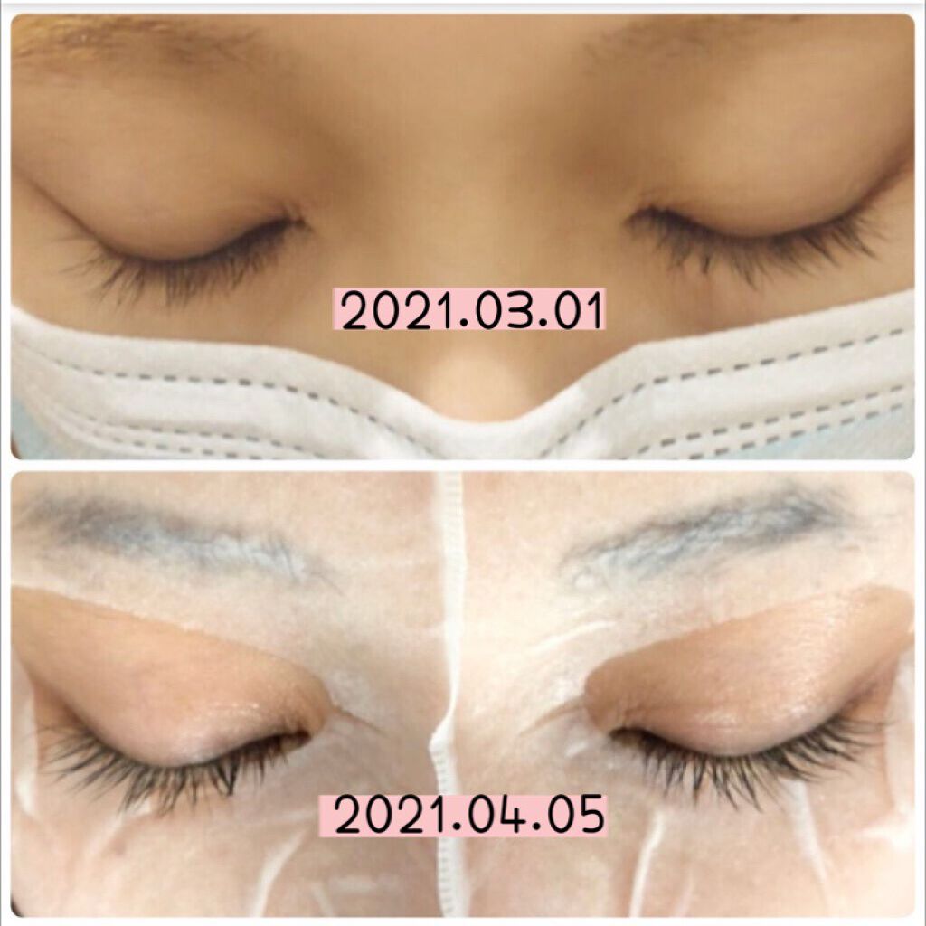 エグータム/アルマダスタイル/まつげ美容液を使ったクチコミ(3枚目)