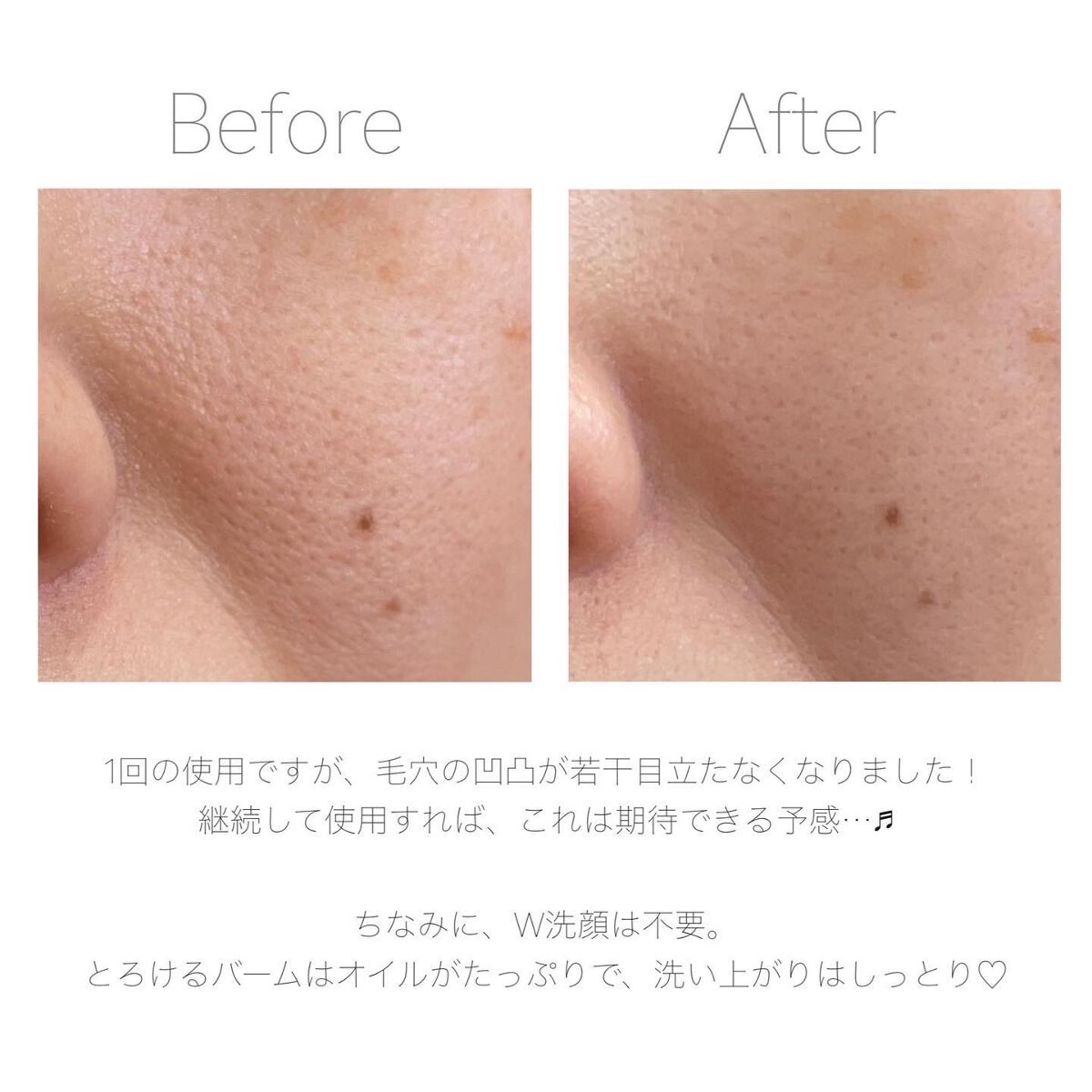 ダヴ すっきり毛穴ケアクレンジングバーム/ダヴ/クレンジングバームを使ったクチコミ(7枚目)