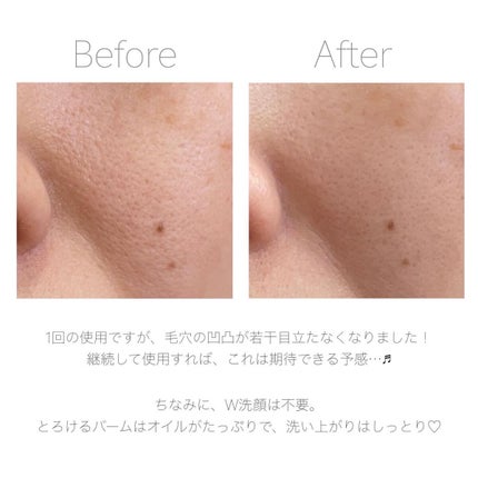 ダヴ すっきり毛穴ケアクレンジングバーム/ダヴ/クレンジングバームを使ったクチコミ(7枚目)