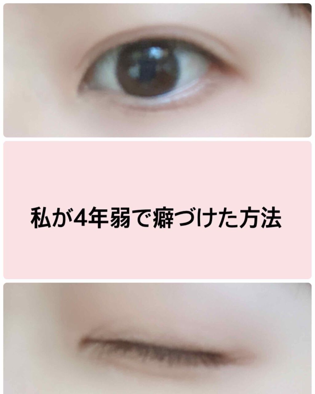 アイビューティー フィクサー WP/アストレア ヴィルゴ/二重まぶた用アイテムを使ったクチコミ（1枚目）