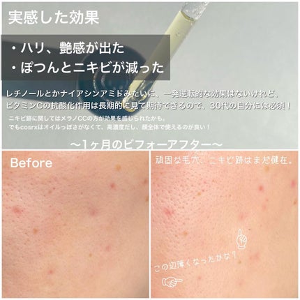 RXザ・ビタミンC23セラム/COSRX/美容液を使ったクチコミ(3枚目)