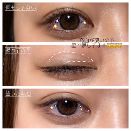 オリシキ アイリッドスキンフィルム /D-UP/二重まぶた用アイテムを使ったクチコミ(4枚目)