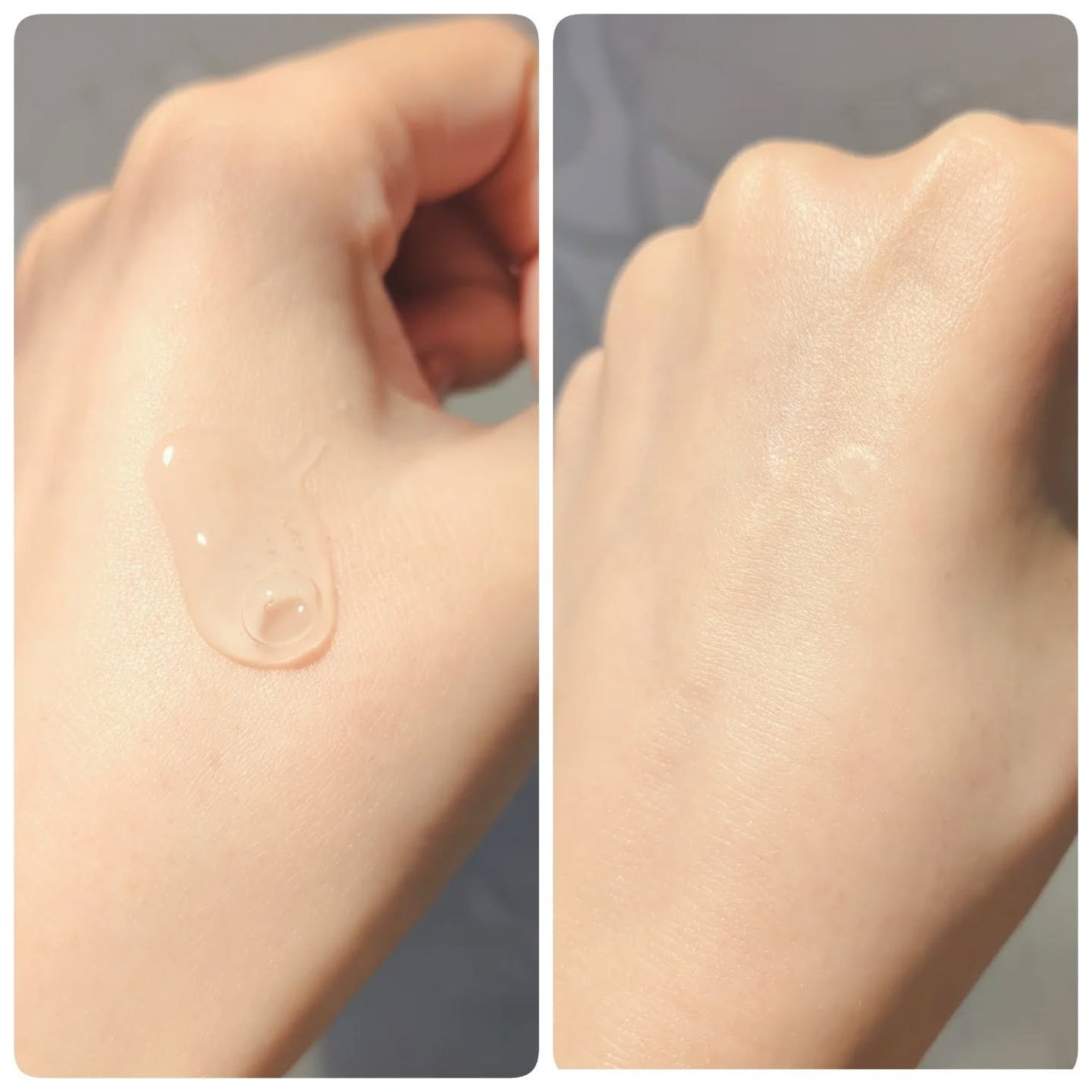 メディリフト ニードルリフトピールセラム/YA-MAN TOKYO JAPAN/美容液を使ったクチコミ(3枚目)