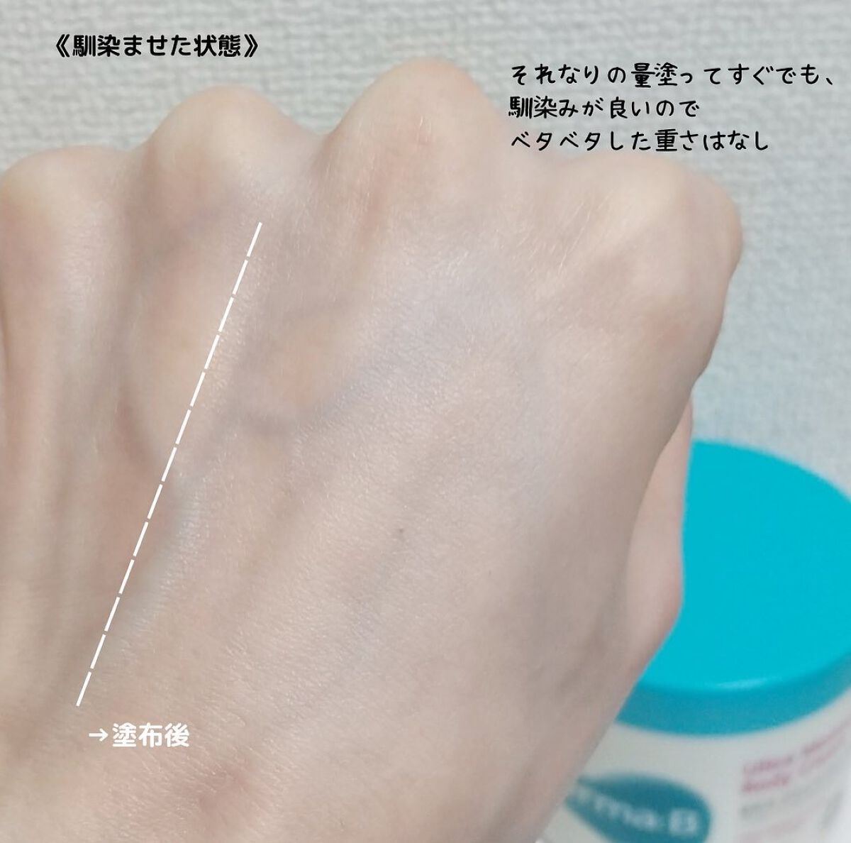 ウルトラモイスチャーボディクリーム/Derma:B/ボディクリームを使ったクチコミ(5枚目)