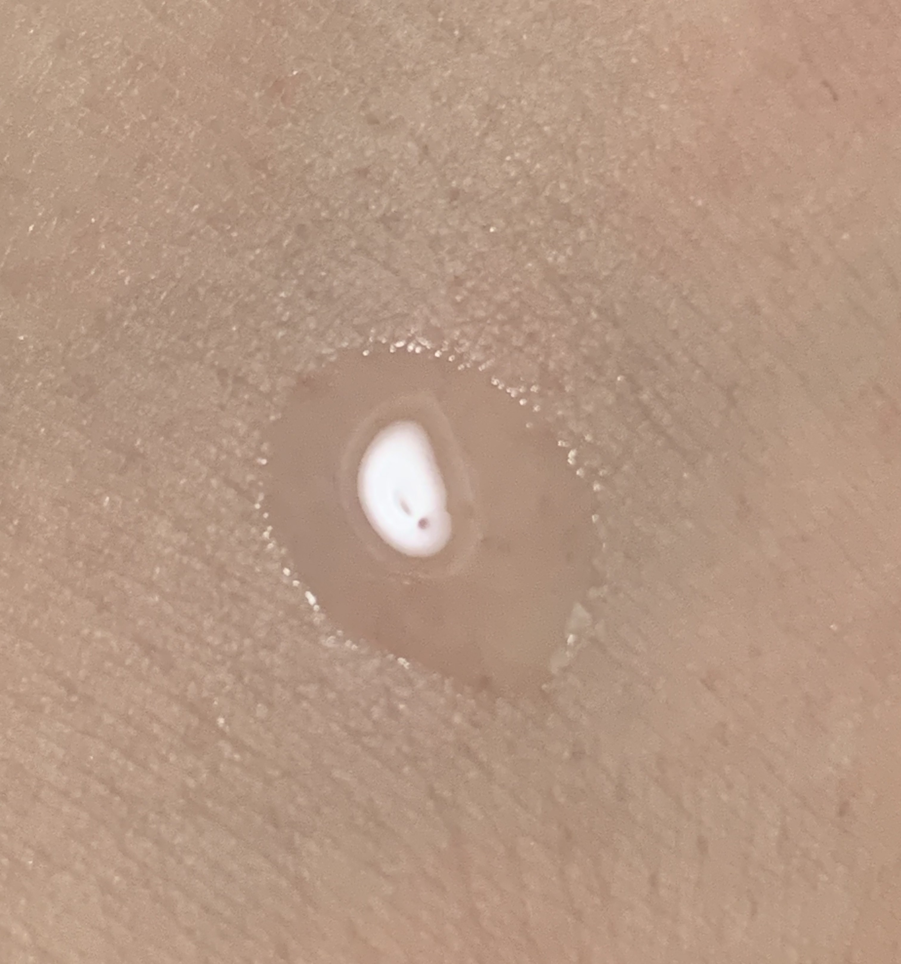 アクネミン QQ/フォルミュール/美容液を使ったクチコミ（2枚目）