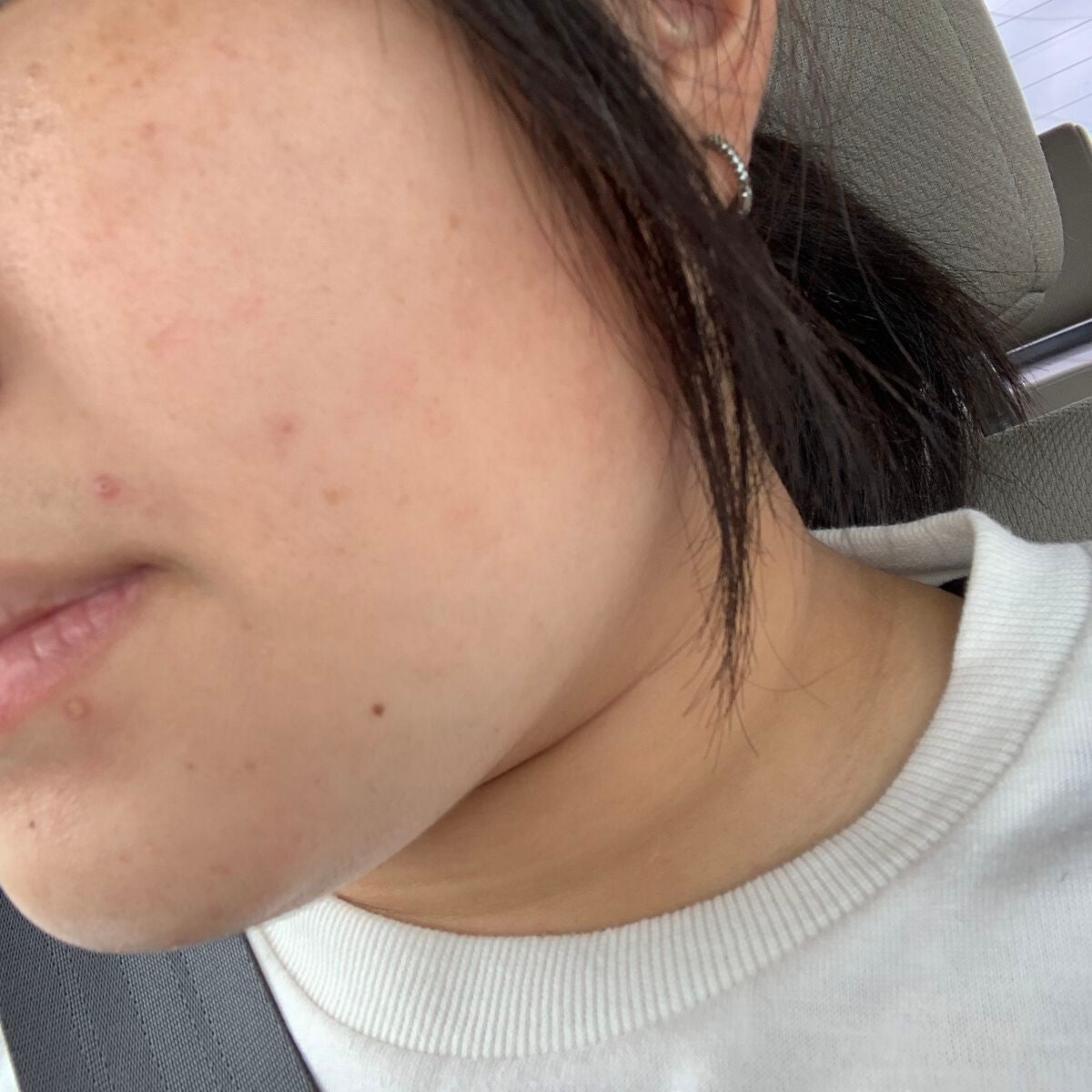 shiny_lips_2mo on LIPS 「⚠️お見苦しい写真失礼🙇♀️🙇♀️最近仕事の疲れでなのか、..」(1枚目)