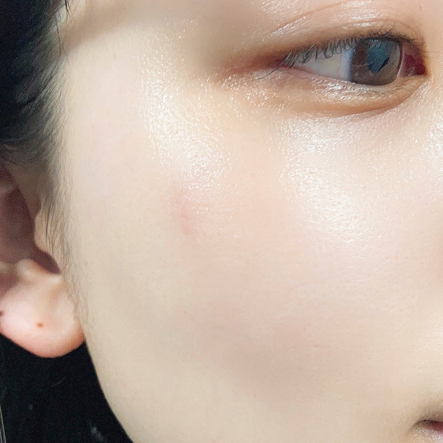 スキンソリューションSOSセラム100ml/FAU/美容液を使ったクチコミ(4枚目)