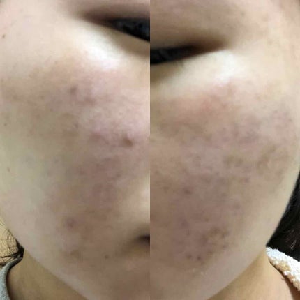 ターマルウォーター/ラ ロッシュ ポゼ/ミスト状化粧水を使ったクチコミ(2枚目)