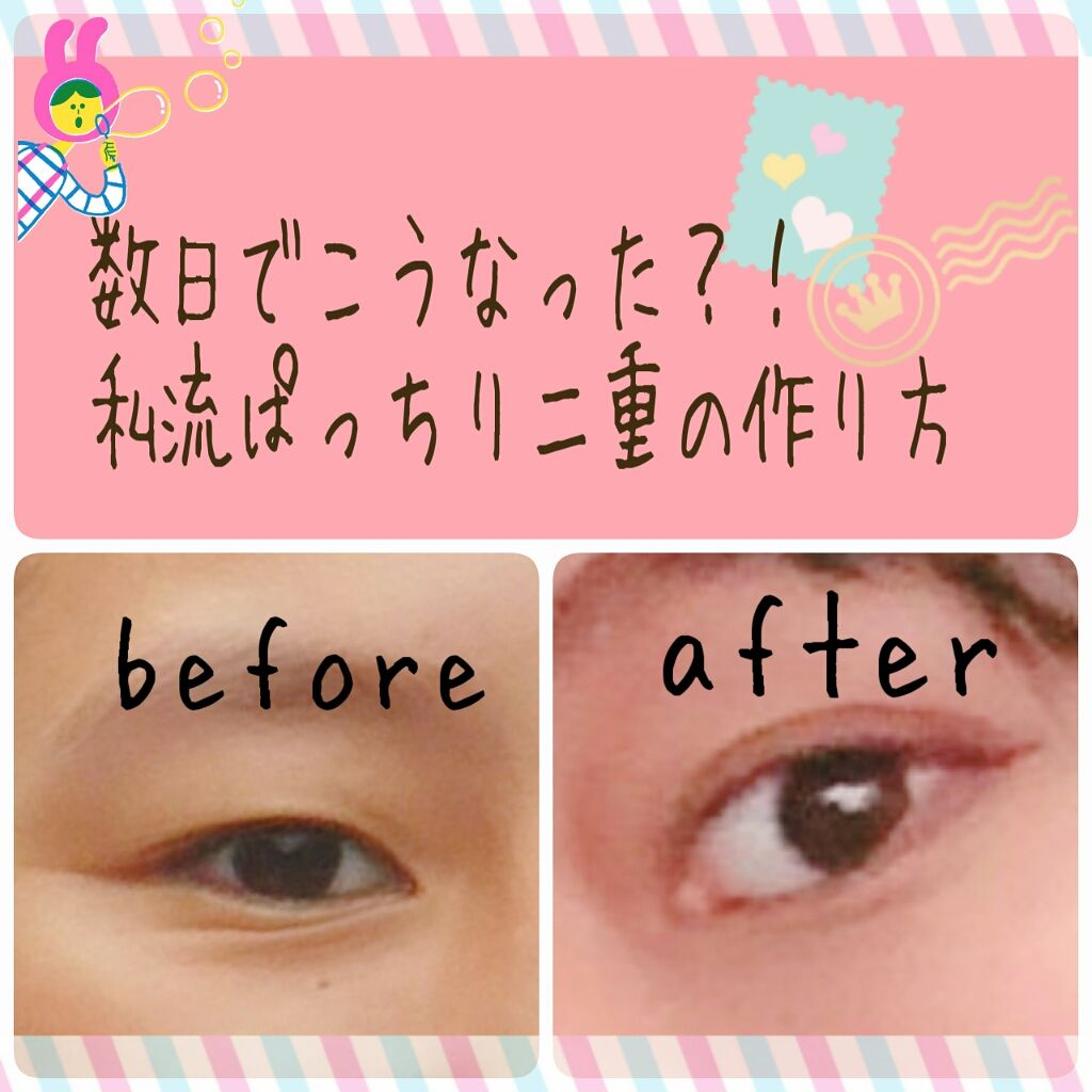 絆創膏/その他を使ったクチコミ（1枚目）