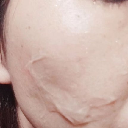 チョコブラ スペシャル毛穴ケアセット/Chocobra/スキンケアキットを使ったクチコミ(5枚目)