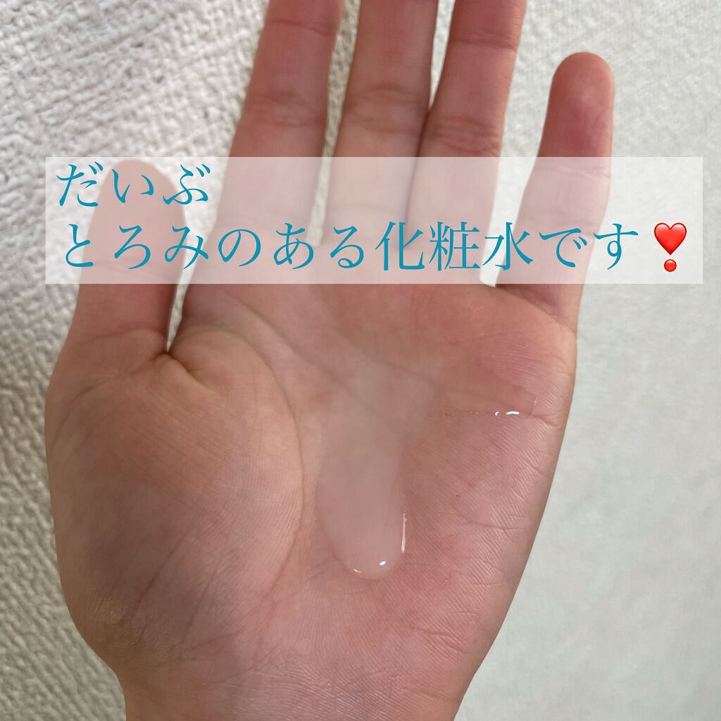 モイスチュア ローション/カルテHD/化粧水を使ったクチコミ（2枚目）