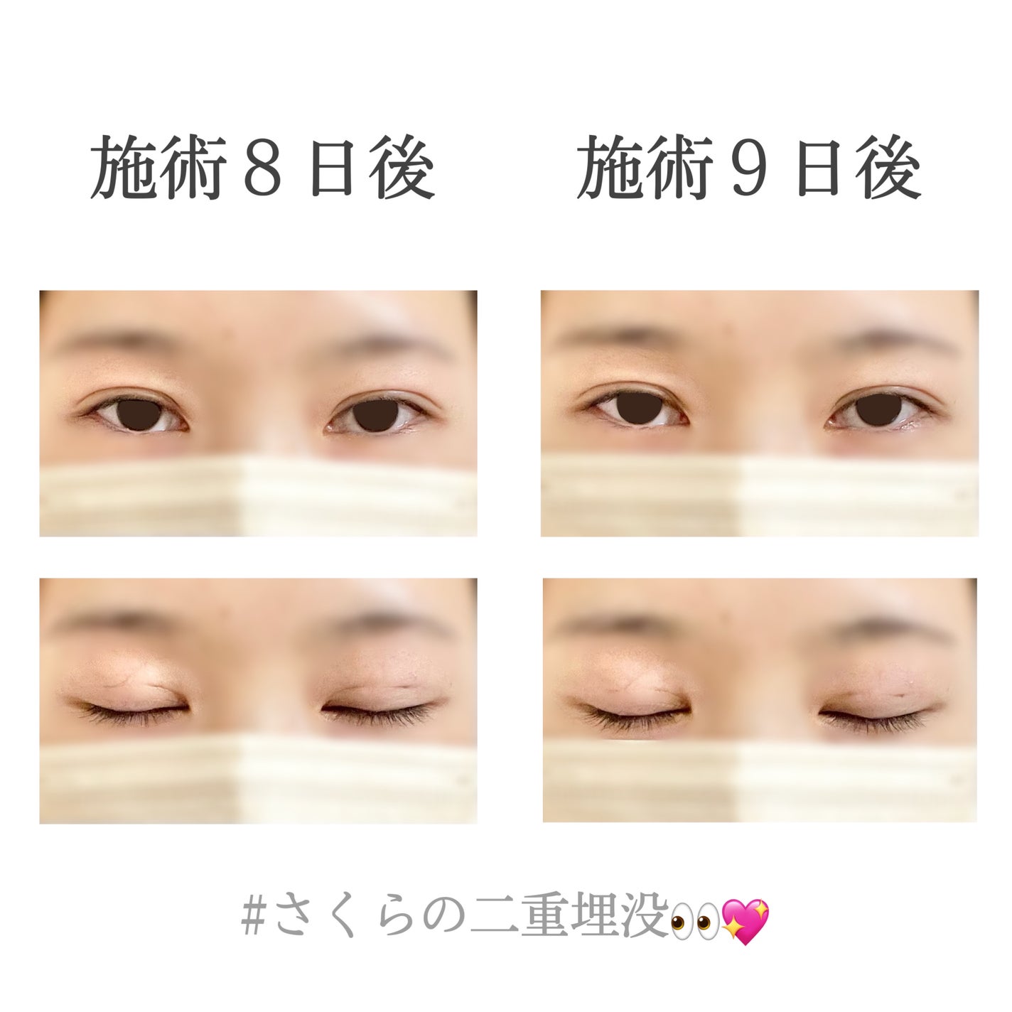 ãããðž on LIPS ãäºéåæ²¡äœéšèšâ¢ðð(æœè¡ç¿æ¥ã10æ¥åŸ)----------..ãïŒ7æç®ïŒ