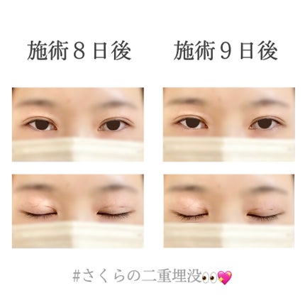 ãããðž on LIPS ãäºéåæ²¡äœéšèšâ¢ðð(æœè¡ç¿æ¥ã10æ¥åŸ)----------..ãïŒ7æç®ïŒ