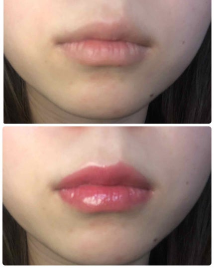 ラシャスリップス/ラシャスリップス/リップグロスを使ったクチコミ(4枚目)