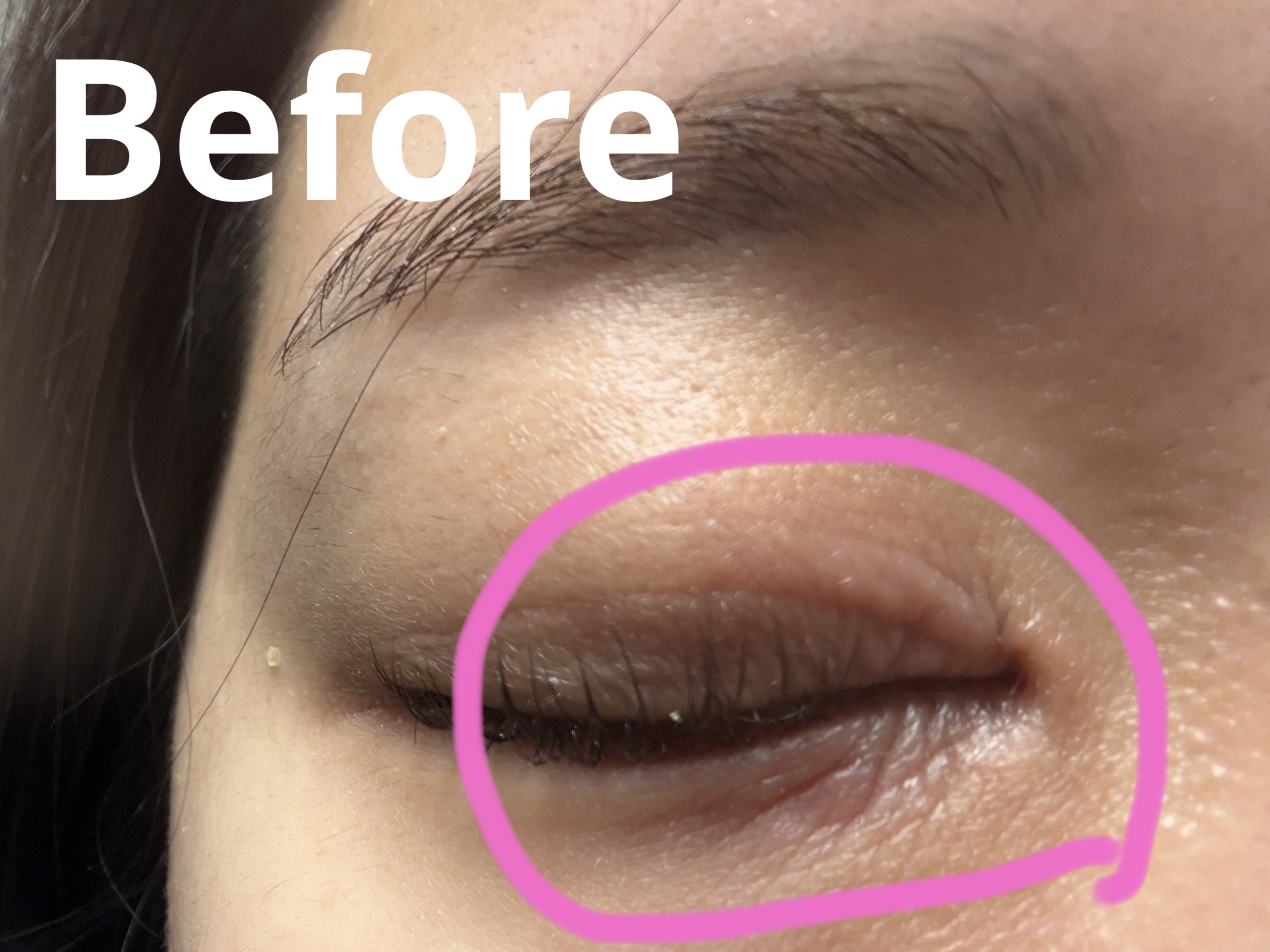 RXザ・ペプチドコラーゲン ハイドロゲルアイパッチ/COSRX/アイケア・アイクリームを使ったクチコミ（3枚目）