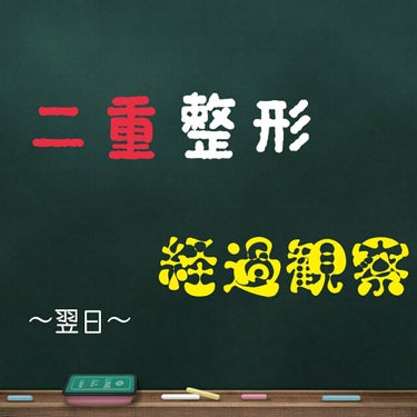 はい、寝起きでそのまま写真撮って投稿してます(ﾆｯｺﾘ)


〜手術翌日〜

 「2日目が一番腫れのピークだよ〜」と言われたのですが
寝起きにも関わらずあんまり腫れてない･･･？ですね

ゴロゴロする感