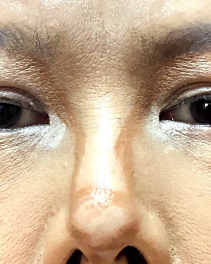 プレイ101スティック カラーコントゥアーデュオ/ETUDE/スティックコンシーラーを使ったクチコミ(4枚目)