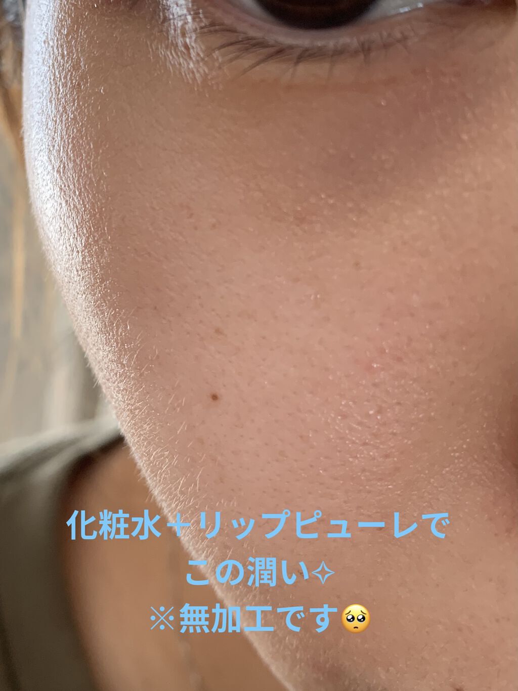 イグニス イオ リッチ ピューレ/IGNIS/美容液を使ったクチコミ（3枚目）