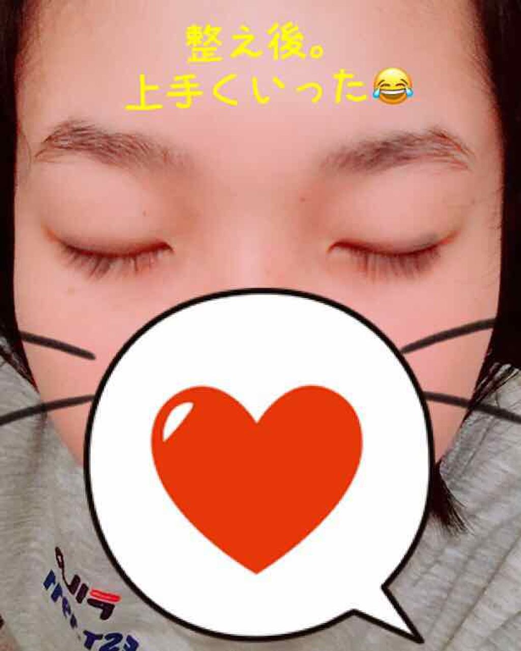 プレミア敏感肌用 Lディスポ/シック/シェーバーを使ったクチコミ(3枚目)