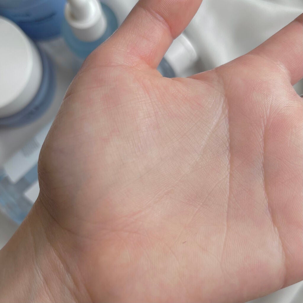 シラカバ 70% 水分ブースティングトナー/Anua/化粧水を使ったクチコミ(4枚目)