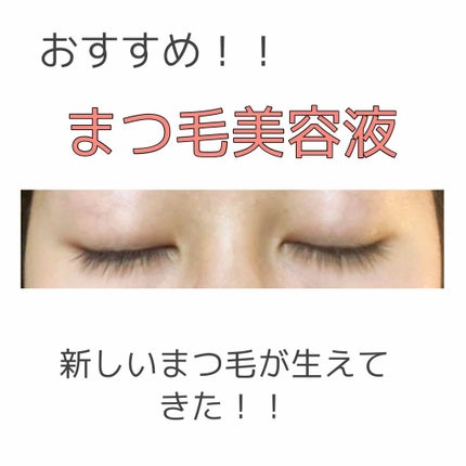 スカルプD ボーテ ピュアフリーアイラッシュセラム/アンファー(スカルプD)/まつげ美容液を使ったクチコミ(1枚目)