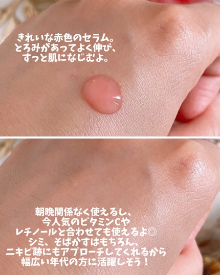 ダークスポットセラム/Anua/美容液を使ったクチコミ(4枚目)