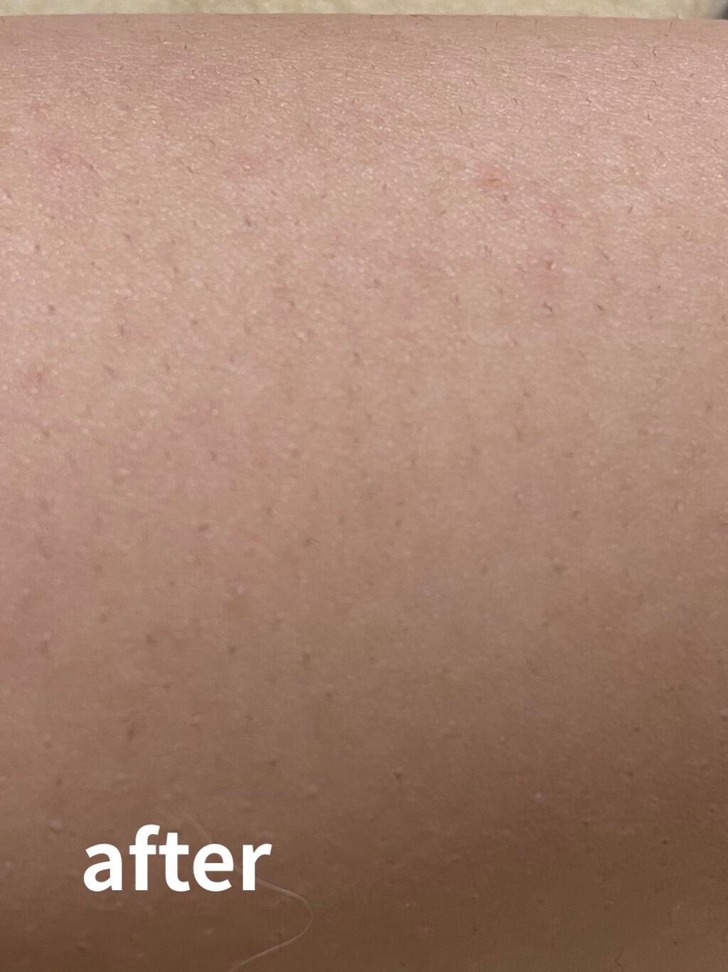 ãã¹ã¿ã€ã 逿¯ã¯ãªãŒã ææèçš/Veet/逿¯ã¯ãªãŒã ã䜿ã£ãã¯ãã³ãïŒ4æç®ïŒ