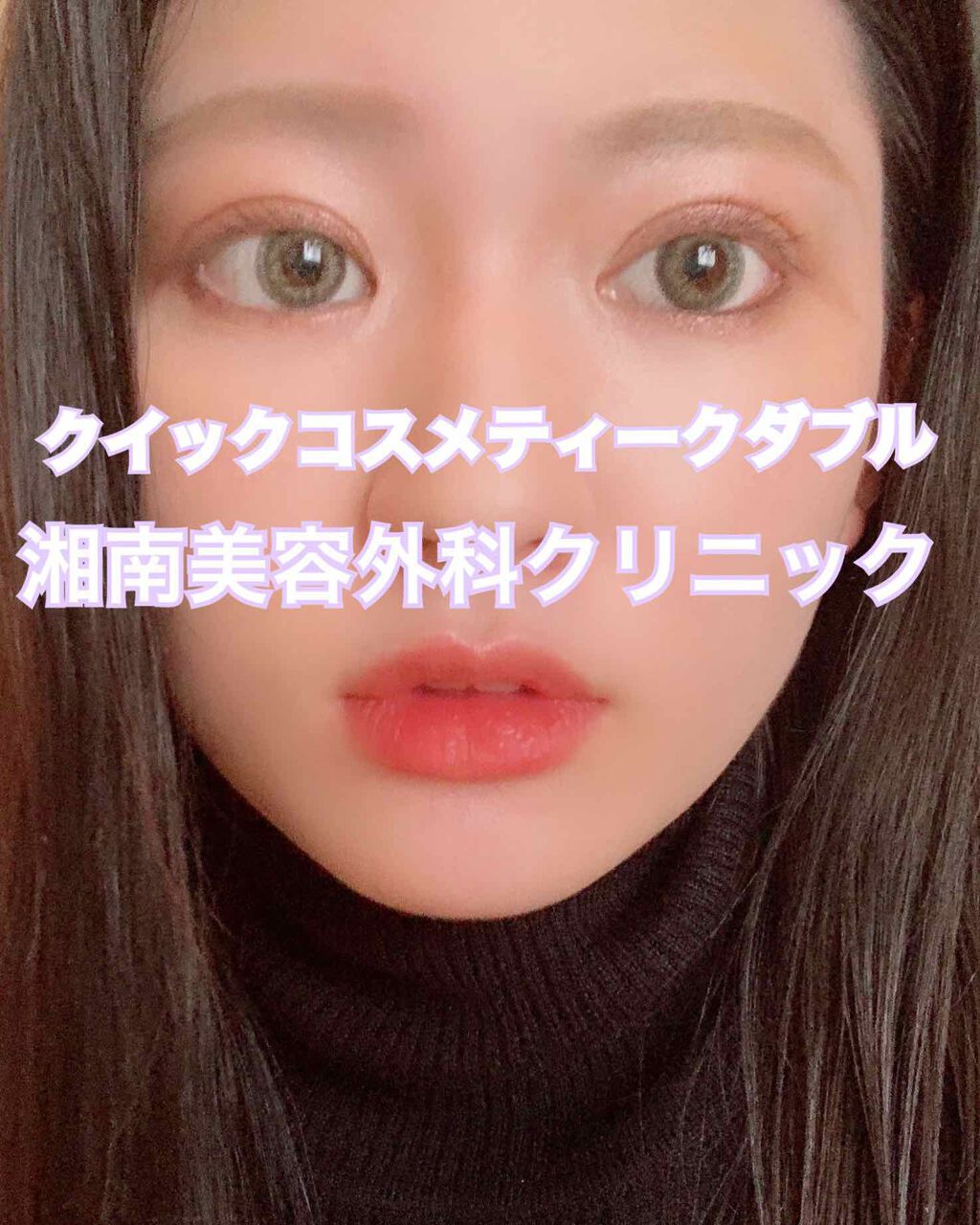 ITSUKI on LIPS 「私がやったクイックコスメティークダブルの二重施術は切らないタイ..」(1枚目)